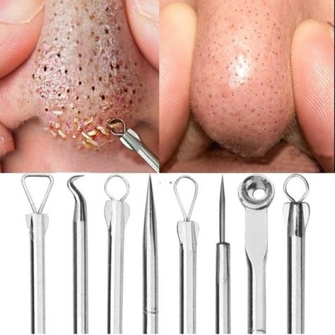 5 Pcs Set - Blackhead Whitehead Pimple Spot Comedone Acne Extractor Remover Popper Tool Kit Pimple Removal, Pimple Popper Tool, Rosebud Salve, Blind Pimple, Prevent Pimples, Pimples Under The Skin, Dior Addict Lip Glow, Mole Removal, Natural Acne Remedies