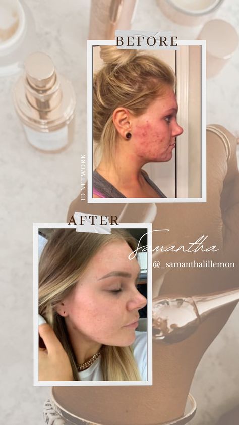 Skincare Testimonial, Monat Skincare, Skin