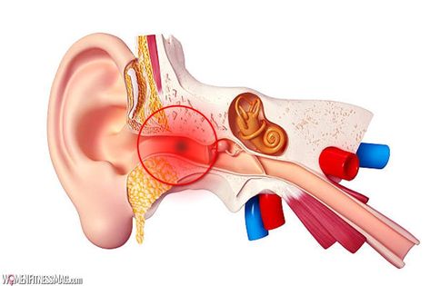 What+Are+Middle+Ear+Infections Sense Of Hearing, Streptococcus Pneumoniae, Wellbeing Activities, Outer Ear, Middle Ear, Ear Infections, Ear Parts, Respiratory Infection, Allergy Symptoms