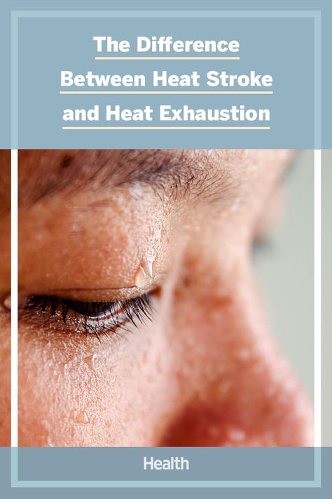 We asked a doctor to explain the difference between heat stroke and heat exhaustion, and how you can recognize the warning signs of each.  #summer #healthytips #symptoms #heatstroke #heatexhaustion #sunsafety Exhaustion Symptoms, Frankincense Oil Uses, Heat Exhaustion, Tomato Nutrition, Heavy Sweating, Calendula Benefits, Zinc Deficiency, Matcha Benefits, Coconut Health Benefits