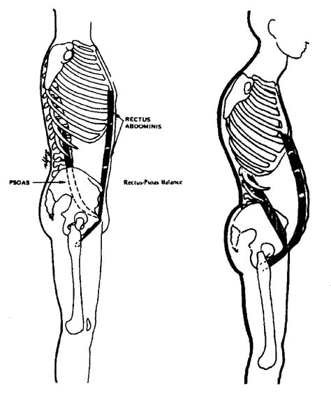 The Psoas Major and Sit Ups