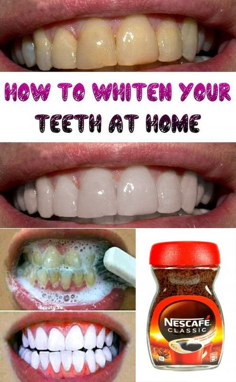 teeth Teeth Whiting At Home, Baby Tooth Decay, Homemade Mouthwash, Alcohol Free Mouthwash, Teeth Whitening Homemade, Teeth Whitening Remedies, Teeth Bleaching, Nice Teeth, Gum Care