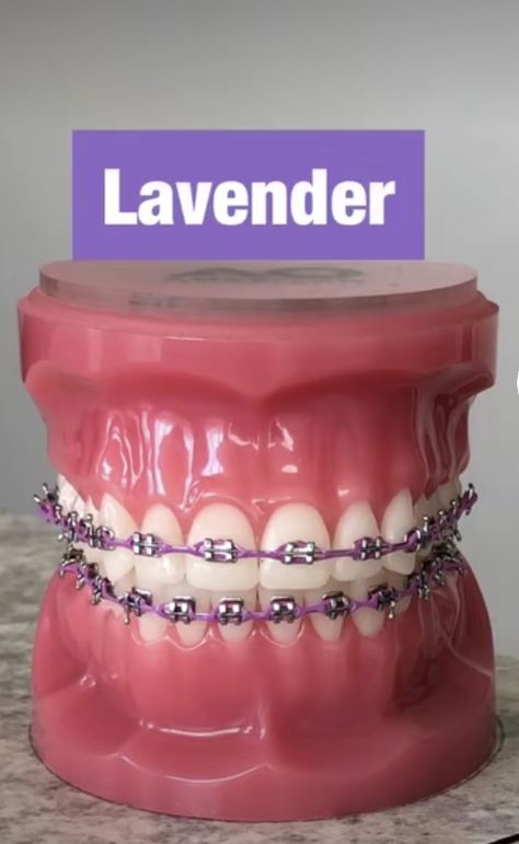 Lavender Braces, Power Chain Braces, Dental Braces Colors, Braces Colors Combinations, Pink Braces, Diy Braces, Braces Bands, Cute Braces Colors, Braces Tips