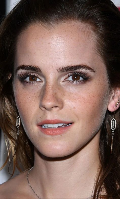 Emma bares her freckles in Paris Celebs With Freckles, Freckles On Lips, Jenna Freckles, Low Cheekbones Women, Makeup For People With Freckles, Slight Freckles, Freckle Placement, Freckles Nose, Subtle Freckles