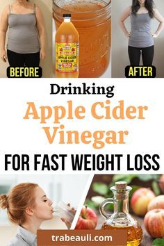 Drinking apple cider vinegar for weight loss fast. Know about how to use it and benefits of it. #ACV #weightloss Drinking Apple Cider Vinegar, Cider Vinegar Benefits, Vinegar Drinks, Baking Powder Uses, Apple Cider Vinegar Drink, Baking Soda Beauty Uses, Organic Apple Cider Vinegar, Natural Cough Remedies, Lose 40 Pounds