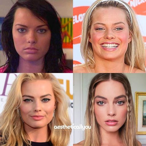 Ohh Margot 💕 Through the years - 2005 to 2019 . #MargotRobbie Margot Robbie Makeup Looks, Margot Robbie Makeup, Margot Robbie Hair, Botox Lips, The Affair, Cheated On, Chic Fall Outfits, Breast Augmentation, Tummy Tucks