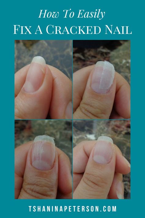 How To Fix Split Nails, Split Nails Remedies, Fix Cracked Nail, Split Nail Repair, Fix Broken Nail, Nail Remedies, Split Nails, Nail Room Ideas, Cracked Nails