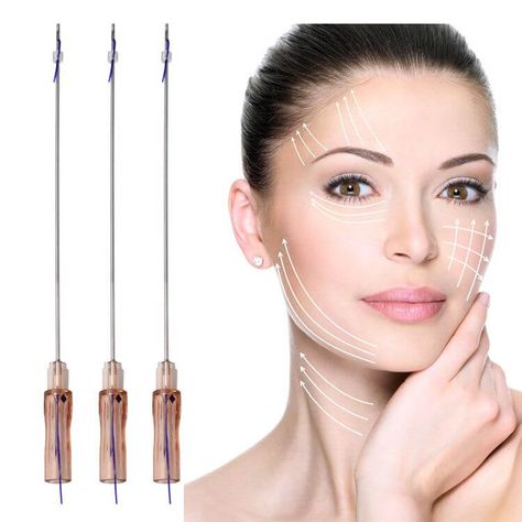 Thread Lift Face, Pdo Thread Lift, Face Threading, Face Fillers, Thread Lift, Dermal Fillers, Face Massage, Lip Fillers, Sagging Skin