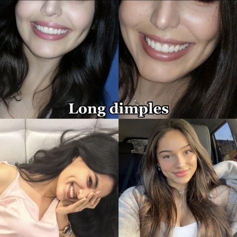 Jaw Reduction Surgery, Plastic Surgery Fail, Face Surgery, Plastic Surgery Gone Wrong, Cheek Fillers, Nose Surgery, Celebrity Plastic Surgery, Celebrities Before And After, Eye Surgery