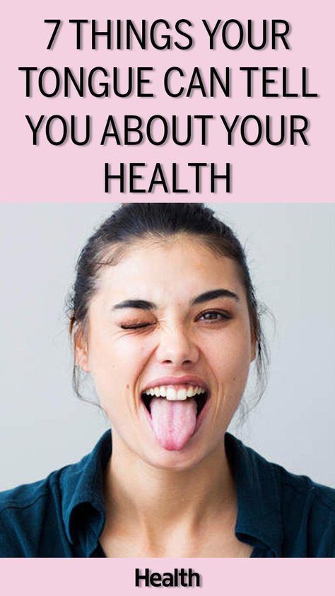 Here's what you need to know about what your tongue might be trying to tell you if you notice any changes to its color or texture. How To Help Nausea, Remove Skin Tags, Medical Notes, Organic Diet, Tongue Health, Health Signs, Boiled Egg Diet, Skin Tags, Nursing Tips