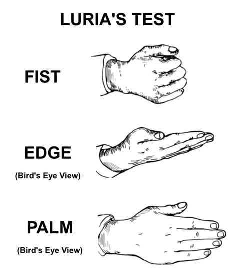 Luria Sequence (Luria's Test) Primer Luria's Test (“fist-edge-palm” test or Luria Sequence) is a task that requires a patient to imitate three hand motions performed by a clinician. Luria's test is part of the Frontal Assessment Battery (FAB) battery of tests. Luria's test assesses for frontal lobe (i.e. - executive) dysfunction or damage, as patients will often have difficulty with fine motor skills and sequencing motor skills. Specifically, it is designed to assess different aspects of execu Executive Dysfunction, Motor Planning, Frontal Lobe, Working Memory, Three Hands, Fine Motor Skills, Fine Motor, Assessment