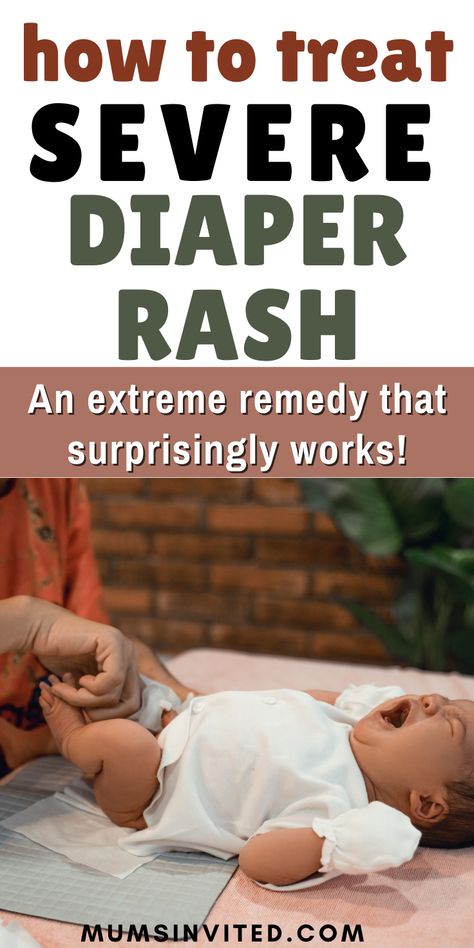 Nappy Rash Remedies Natural, Diaper Rash Remedy Severe, Natural Diaper Rash Remedies, Diaper Rash Cream Recipe, Natural Diaper Rash Cream, Home Remedies For Rashes, Rash Remedies, Diaper Rash Remedy, Rashes Remedies