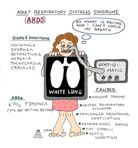 Acute Respiratory Distress Syndrome (a.k.a.: Noncardiogenic Pulmonary Edema, Adult Respiratory Distress Syndrome, Shock Lung) Acute Respiratory Distress, Respiratory Distress, Nursing Information, Nursing Mnemonics, Surgical Nursing, Medical Surgical Nursing, Nursing School Survival, Respiratory Care, Critical Care Nursing