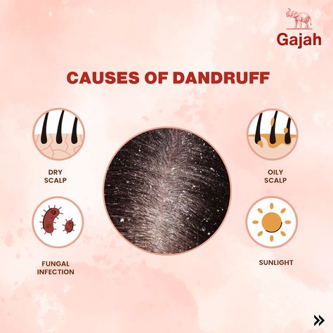 Struggling with Dandruff and Hair Loss? Gajah is Here to Help! Dandruff and hair loss are common hair concerns that many of us face at some point. These issues can be frustrating and even embarrassing, affecting not only the health of your hair but also your confidence. The good news? Gajah has got you covered! Whether you're struggling with dandruff, hair loss, or both, Gajah’s range of natural products is designed to nourish your scalp, strengthen your hair, and promote regrowth. Dandruff... Dandruff Hair, Hair Concerns, Oily Scalp, Fungal Infection, The Good News, Dandruff, Natural Products, Good News, The Good