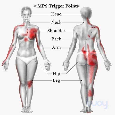 Myofascial Release Massage, Forward Head Posture Exercises, Myofascial Pain Syndrome, Knee Pain Remedy, Calf Cramps, Muscle Pain Relief, Muscles In Your Body, Myofascial Release, Knee Exercises