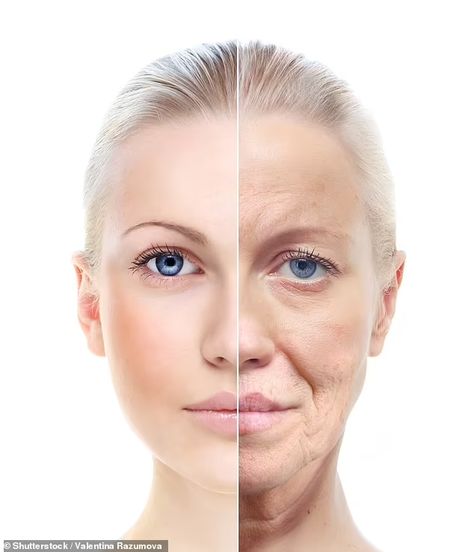 Priorities Change, Home Remedies For Skin, Yoga Facial, Saggy Skin, Dermal Fillers, Aging Process, Wrinkle Remover, Style Mistakes, Skin Tightening