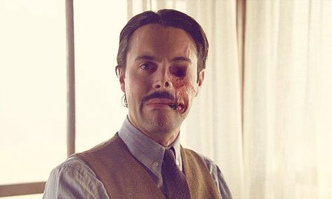 Richard Harrow takes off his mask for Angela Dismemberment Reference, Burned Skin Drawing, Taking Off Mask Reference, Burn Marks Reference, Facial Scar Reference, Masked Oc, Burnt Face, Scar Face, Face Reference