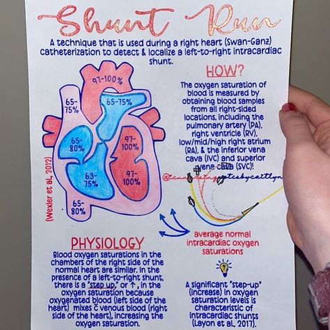 Med Surg Cardiovascular, Cardiac Output Nursing, Heart Chambers, Heart Pressure, Cardiac Cath, Cath Lab Nursing, Right Heart Catheterization, Superior Vena Cava, V Fib Cardiac Rhythms