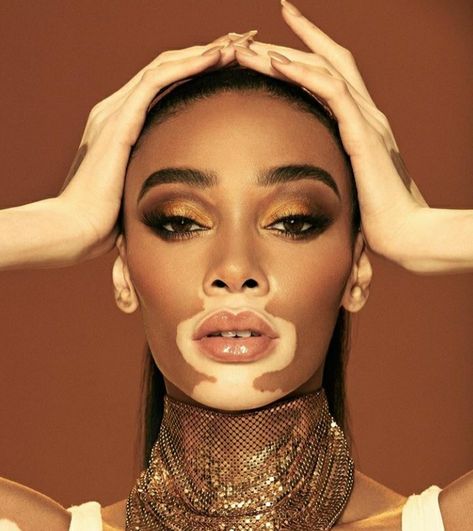 Winnie Harlow Deep Autumn Color Palette, Autumn Color Palette, Black Actresses, Winnie Harlow, Deep Autumn, New Background Images, Michael Myers Halloween, Beauty Standards, New Backgrounds