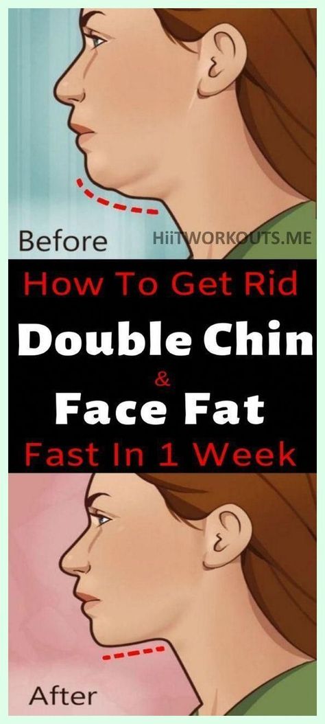 The Best Exercises For Getting Rid Of That Unwanted Double Chin Exercise Double Chin, Autogenic Training, Rid Of Double Chin, Skin Tightening Stomach, Double Chin Exercises, 70 Style, Chin Exercises, Muscle Stretches, Face Fat