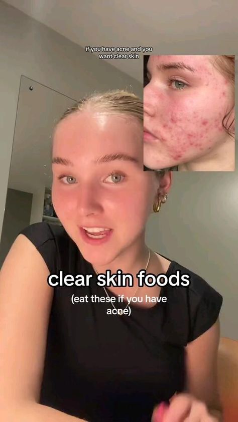 Natural Clear Skin 🌿😌 Natural Clear Skin, Regular Skin Care Routine, Facial Massage Tool, Face Care Routine, Serious Skin Care, Best Skin Care Routine, Skin Collagen, Clear Skin Tips, Nature Instagram