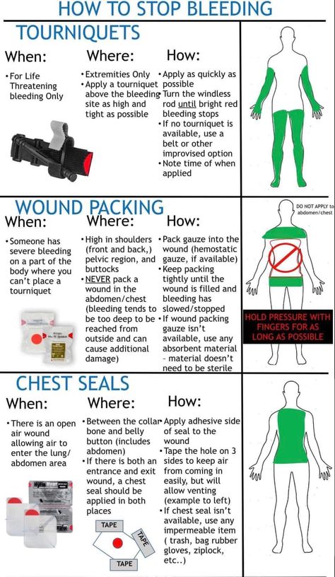 Survival Skills Emergency Preparedness, Emergency Prepardness, Survival Skills Life Hacks, Medical School Essentials, Survival Life Hacks, Survival Techniques, Prepper Survival, Life Help, Survival Life