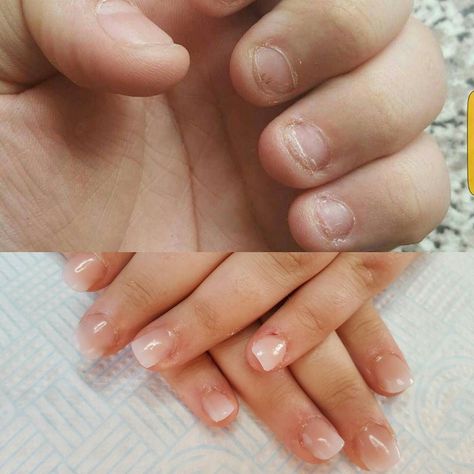 Wide Nail Bed, Short Bitten Nails, Bitten Nails, Acrylic Ombre, Wedding Nail Polish, Natural Acrylic, Sculptured Nails, Spring Acrylic Nails, Nails Natural