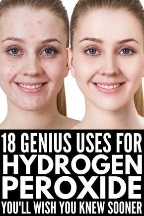 Peroxide Uses, Coconut Oil Face Mask, Hydrogen Peroxide Uses, Coconut Oil For Face, Prom Makeup Looks, Fall Makeup Looks, Long Layered Haircuts, Winter Makeup, Hydrogen Peroxide