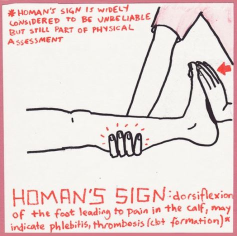 Homans sign for Thrombosis ... #DVT Dvt Nursing, Homans Sign, Medical Study, Postpartum Nursing, Nursing Cheat, Pta School, Nclex Study, Picu Nurse, Playing Doctor