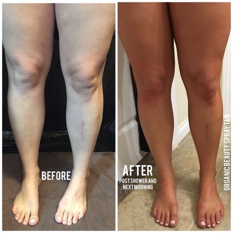 Before and after TAN Tanning Photos, Tan Before And After, Spray Tan Tips, Tan Tips, Tanning Business, Fertility Tea, Body Bronzer, Loving Tan, Spray Tan Solution