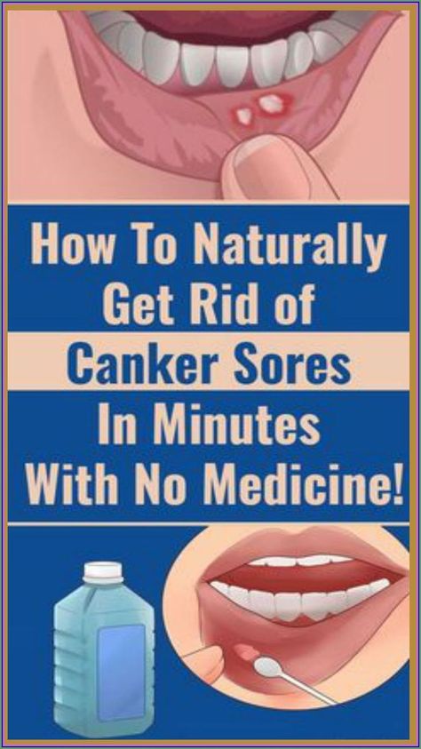 Fat Belly, Caring Meaning, Canker Sore, Stronger Teeth, Oral Health Care, Lose 40 Pounds, Tooth Decay, Warning Signs, Oral Health