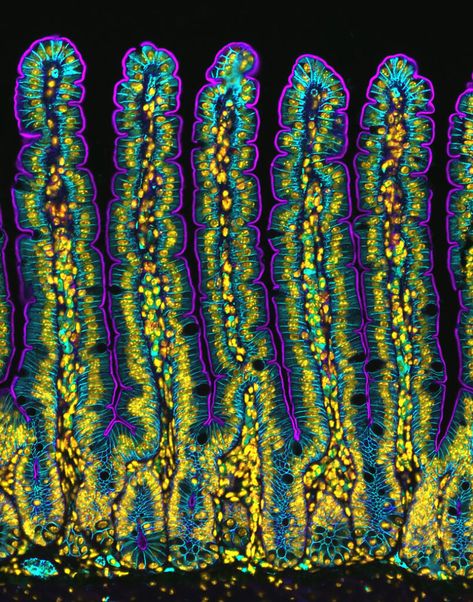 Nikon Small World, Augusta University, Store Architecture, Sunset Moth, Small Intestine, Best Nature Images, Microscopic Images, Slime Mould, Regenerative Medicine