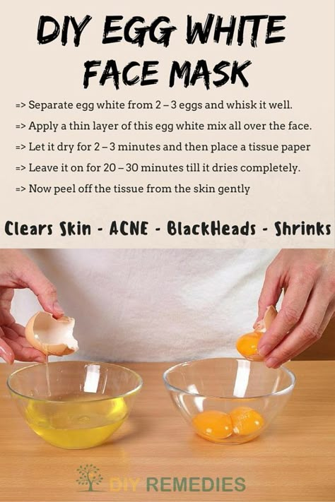 Blackheads Products, Egg Face Mask, Egg White Mask, Egg White Face Mask, Vicks Vaporub Uses, Uses For Vicks, Remove Warts, Acne Mask, For Blackheads