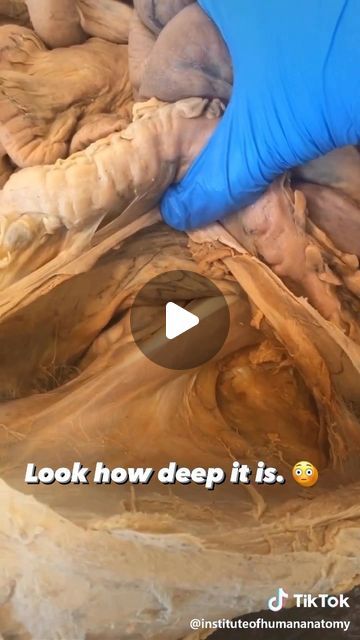 Dr. Tom Walters, DPT, OCS on Instagram: "💥𝐏𝐬𝐨𝐚𝐬 𝐀𝐧𝐚𝐭𝐨𝐦𝐲💥 —— 👉Can you really release the psoas muscle with massage techniques? Probably not. This video from @instituteofhumananatomy highlights just how deeply this muscle is located. - 🔎Psoas major is the deepest core muscle and the only muscle that attaches the trunk to the lower limb. It runs from the vertebrae and discs of the low back (T12-L5) down to the lesser trochanter on the inside of the femur. This unique configuration allows psoas to possess the dual role of spinal stabilizer and hip flexor. - 🧠If you are experiencing pain in the low back, sacroiliac joint region or hip, it is worth your time to determine whether or not addressing your hip flexors may help. This can be most easily accomplished by adding a bit of Labral Tear Hip, Back Massage Technique, Lower Back Massage Techniques, Psoas Stretch Release, Lower Limb Anatomy, Hip Muscles Anatomy, Psoas Muscle Pain, Anatomy Videos, Knee Mobility