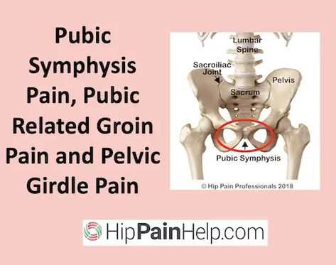 Pubic Symphysis Pain, Pubic Related Groin Pain and Pelvic Girdle Pain Pelvic Girdle Pain Relief, Hip Flexor Pain, Inner Thigh Muscle, Pelvic Girdle, Pelvic Bone, Referred Pain, Fitness Goal, Thigh Muscles, Pelvic Pain