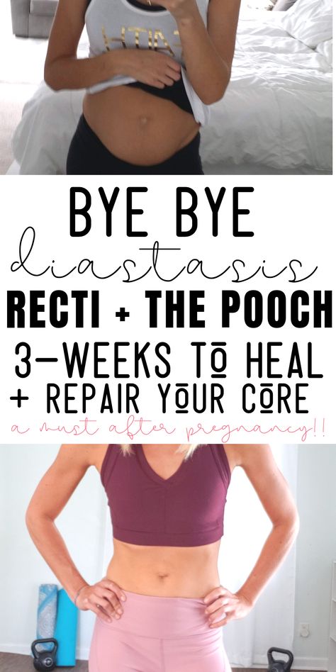 EVERY MAMA DO THIS!!! Heal diastasis recti with this ab rehab program created by a mom of 3 and Pilates instructor! Super simple to do, and videos! #diastasisrecti #mommypooch #postpartum #losethepooch #newmommy Diastasis Recti Program, An Rehab Exercises, Postpartum Diastasis Recti Exercises, Post Partum Pilates, Ab Rehab Exercises, Ab Rehab Post Pregnancy, Postpartum Ab Rehab, Pilates For Diastasis Recti, Postpartum Workout Diastasis Recti