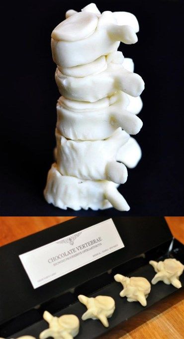 Edible chocolate vertebrae by Sarah Hardy Halloween Beverages, Gothic Wedding Cake, Bone Model, Creepy Food, Doctor Cake, Chocolate Sculpture, Chiropractor Gifts, Chocolate Ganache Filling, Chocolate Sculptures