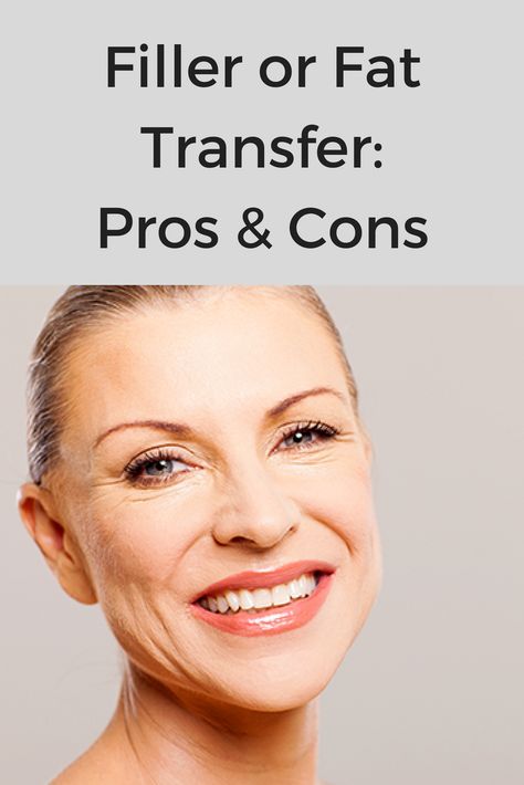 Fillers vs. Fat Transfer: Pros & Cons | For many years, facial rejuvenation was limited to skin resurfacing with lasers and peels, and various surgical soft tissue repositioning procedures. But now, with so many non-surgical injectable options available, it’s often difficult to decide which is right for you. Face Dermal, Cheek Fat, Sagging Cheeks, Sagging Face, Under Eye Fillers, Face Fillers, Cheek Fillers, Facial Fillers, Cosmetic Injectables