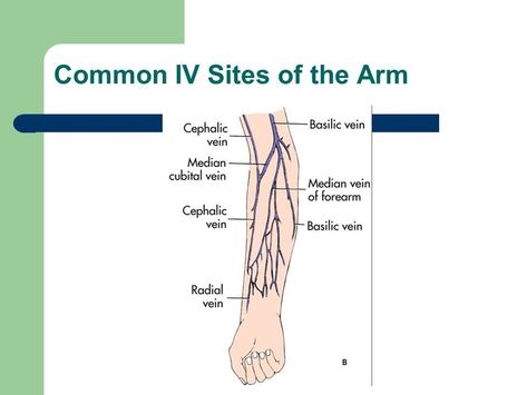 Common IV Sites of the Arm Premed Notes, Injection Angles, Iv Sites, Phlebotomy Notes, Pediatric Nursing Study, Medical Terminology Study, Nurse Skills, Nursing School Inspiration, Medical Assistant Student