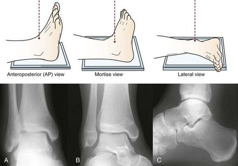 Diagnostic Radiography, Radiography Student, Radiology Schools, Medical Radiography, Radiologic Technology, Medical Assistant Student, Radiology Student, Computed Tomography, Radiology Technician