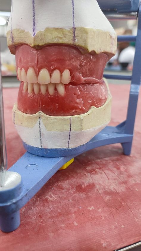 Complete Denture, Dental Lab Technician, Dental Assistant School, Teeth Anatomy, Dentist Art, Dental Images, Dental Aesthetics, Dental Hygiene School, Dentistry Student