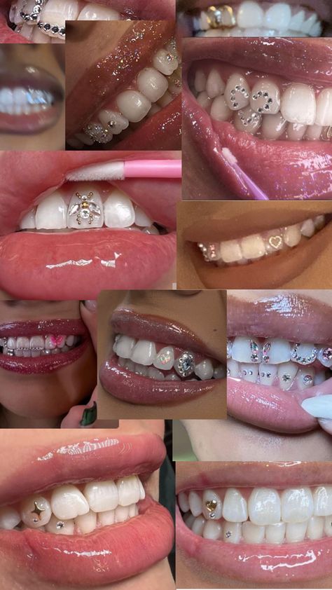 Pretty Teeth, Dental Jewelry, Grillz Teeth, Cute Braces, Diamond Teeth, Dope Jewelry Accessories, Braces Colors, Cute Tooth, Tooth Gems