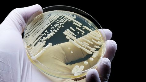 New fungal infection discovered in China | Live Science Types Of Fungi, Bacterial Infection, Fungal Infection, Human Behavior, Alzheimers