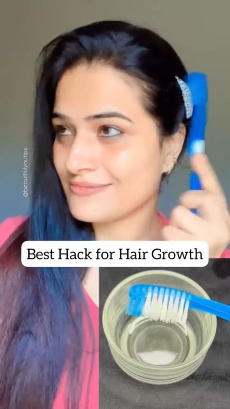 Hair Growth Tips Castor Oil, Hair Growth Tips Faster Overnight, Vitamin E Capsules For Hair Growth, Monsoon Hair Care Tips, Rapid Hair Growth In A Week, Hair Growth Faster In A Week, Extreme Hair Growth Fast, Fast Hair Growth In A Week, Hair Growth In A Month