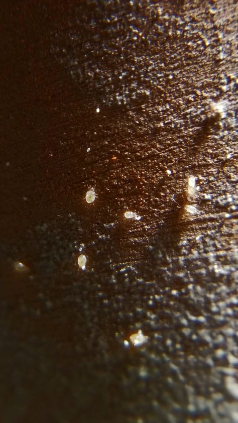 These are tiny white bugs on a clay terracotta pot. They are soil mites. Soil Mites, Dust Mites Bites, Demodex Mites, Bug Repellent, Pregnant Diet, Diatomaceous Earth, Health Knowledge, Dust Mites, Sleep Deprivation