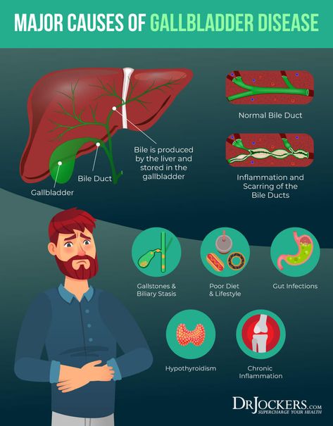 Bile Salts Gallbladder Surgery, Gallbladder Supplements, Gallbladder Diet After Surgery, No Gallbladder Diet, Diet After Gallbladder Removal, Post Gallbladder Surgery Diet, Gallbladder Recipes, Gallbladder Surgery Diet, No Gallbladder