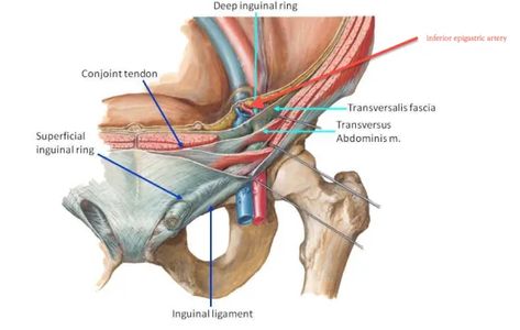 Inguinal Canal , location, boundaries formation and contents , Anatomy QA Medicine University, Rectus Abdominis Muscle, Transversus Abdominis, Abdominal Aorta, C Section Scars, Gross Anatomy, Musculoskeletal System, Bullet Bra, Lower Limb