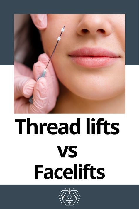 Tired of sagging skin and jowls? Read our blog to learn more if you are trying to decide between a thread lift and a facelift.   Click through to learn more!  #minifacelift #threading #wrinklereduction #antiaging #plasticsurgery #facialaesthetics #deepplanefacelift Thread Lift Before And After, Pdo Thread Lift Before And After, Thread Face Lift, Thread Lift Face, Mini Face Lift, Face Threading, Facelift Procedure, Laser Skin Resurfacing, Thread Lift