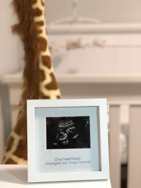 Ultrasound Picture Frame, Pregnancy Announcement Sonogram, Baby Reveal Gift, Gift for Mom, New Mom, One Heartbeat Changed Our Lives Forever https://etsy.me/3aSXG8Y #babygift #pregenantgift #wall #ultrasoundframe #sonogramframe #babysfirstchristmas Baby Ultrasound Pictures, Ultrasound Picture Frame, Ultrasound Frame, Sonogram Pictures, Baby Ultrasound, Baby Announcement Pictures, Ultrasound Pictures, Baby Heartbeat, Pregnancy Announcement Cards