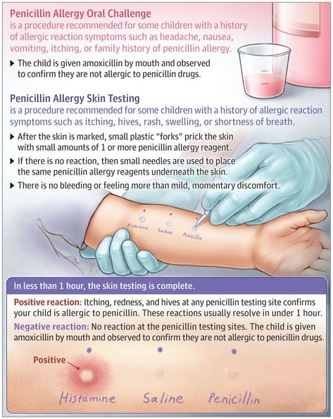 Penicillin Allergy, Asthma Attack, Respiratory Disease, Natural Asthma Remedies, Medical Tips, Asthma Remedies, Asthma Relief, Asthma Inhaler, Medical Procedures